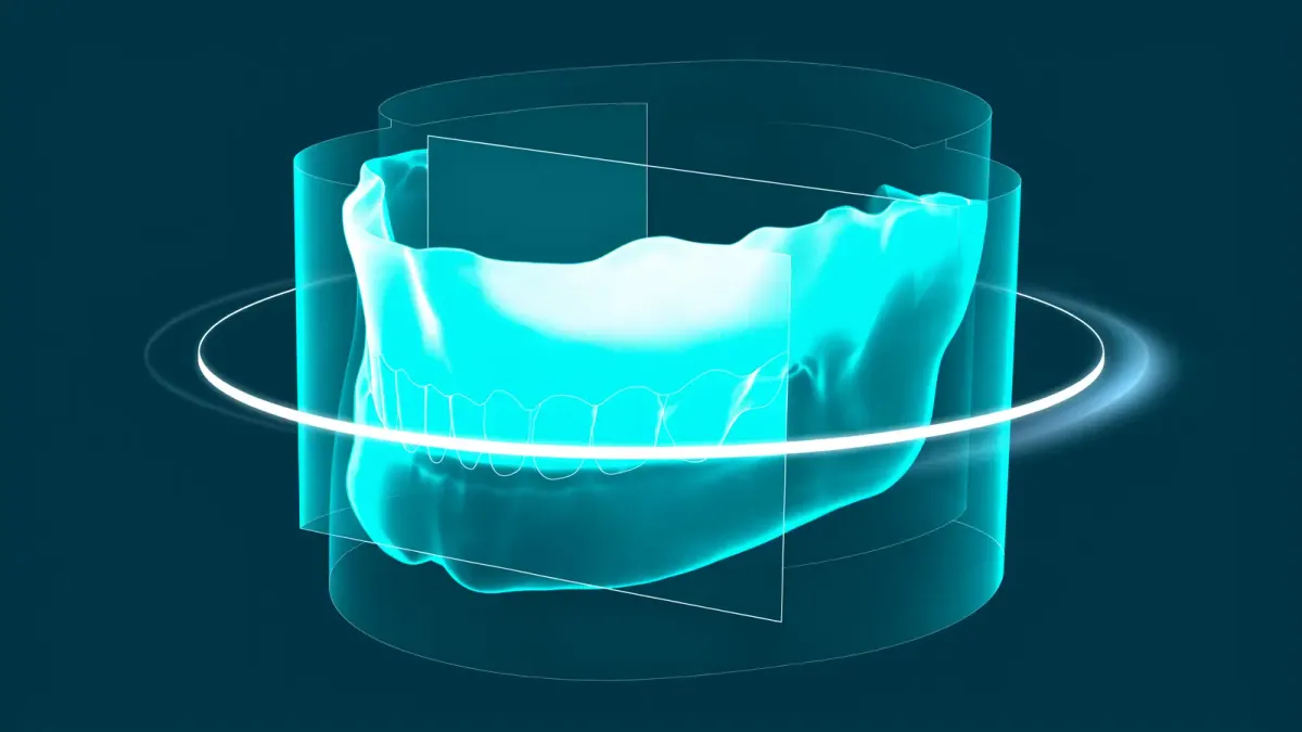 A dental professional reviewing a CBCT cone-beam computed tomography 3D scan on a clinical workstation