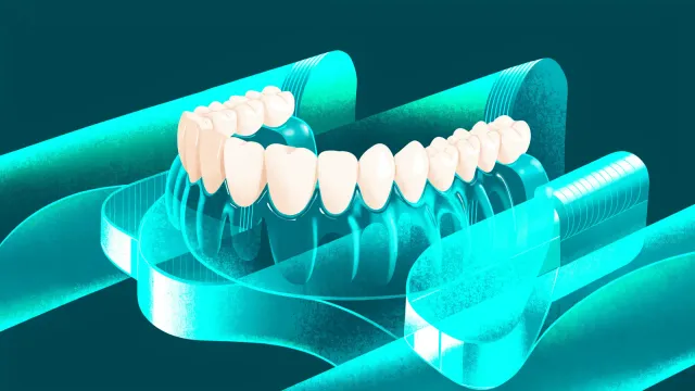 A digitally designed denture on screen next to a 3D printer