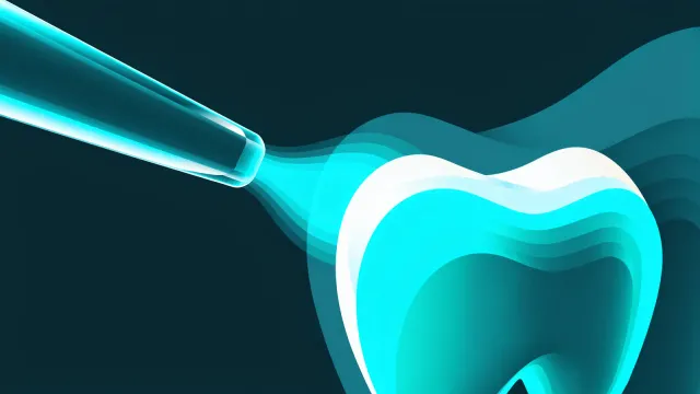 iTero Lumina intraoral scanner wand shown in a clinical dental setting