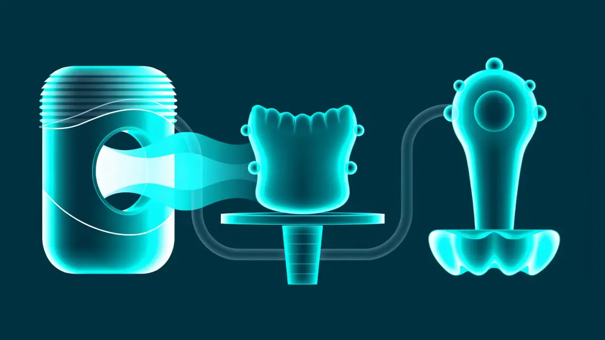 Straumann BLX implant and digital planning software displayed on a dental workstation monitor